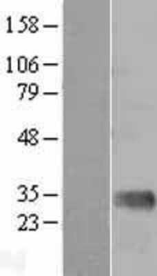 Western Blot: Mannan Binding Lectin Overexpression Lysate (Adult Normal) [NBL1-12927] Left-Empty vector transfected control cell lysate (HEK293 cell lysate); Right -Over-expression Lysate for Mannan Binding Lectin.