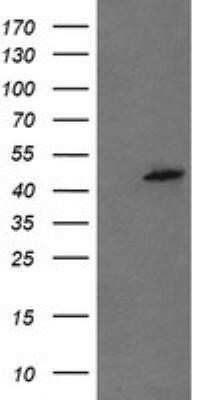 Western Blot: Mannose Phosphate Isomerase Antibody (OTI4G7) - Azide and BSA Free [NBP2-72584] - Analysis of HEK293T cells were transfected with the pCMV6-ENTRY control (Left lane) or pCMV6-ENTRY Mannose Phosphate.