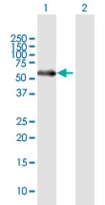 Western Blot: Matrilin-1 Antibody [H00004146-B01P] - Analysis of MATN1 expression in transfected 293T cell line by MATN1 polyclonal antibody.  Lane 1: MATN1 transfected lysate(54.56 KDa). Lane 2: Non-transfected lysate.