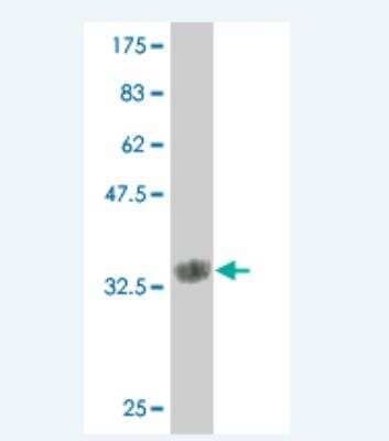 Western Blot: Matrilin-2 Antibody (2B8) [H00004147-M01] - Detection against Immunogen (37.84 KDa) .