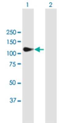 Western Blot: Matrilin-2 Antibody [H00004147-B01P] - Analysis of MATN2 expression in transfected 293T cell line by MATN2 polyclonal antibody.  Lane1:MATN2 transfected lysate(103.07 KDa). Lane2:Non-transfected lysate.