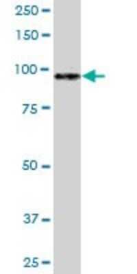 Western Blot: Matrilin-2 Antibody [H00004147-D01P] - Analysis of MATN2 expression in human kidney.