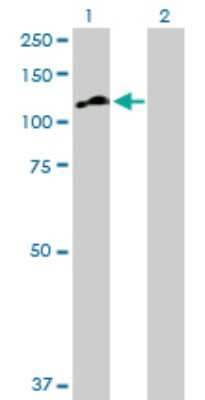 Western Blot: Matrilin-2 Antibody [H00004147-D01P] - Analysis of MATN2 expression in transfected 293T cell line by MATN2 polyclonal antibody.Lane 1: MATN2 transfected lysate(104.80 KDa).Lane 2: Non-transfected lysate.