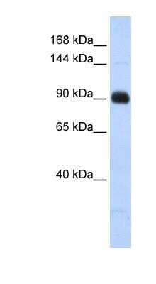 Western Blot: Matrilin-2 Antibody [NBP1-53142] - Human Lung lysate, concentration 0.2-1 ug/ml.