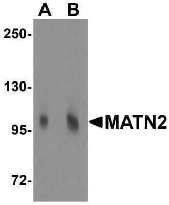 Western Blot: Matrilin-2 Antibody [NBP1-76328] - Analysis of MATN2 in 3T3 cell lysate with MATN2 antibody at (A) 1 and (B) 2 ug/mL.