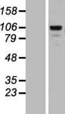 Western Blot: Matrilin 2 Overexpression Lysate (Adult Normal) [NBL1-12915] Left-Empty vector transfected control cell lysate (HEK293 cell lysate); Right -Over-expression Lysate for Matrilin 2.