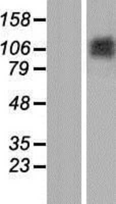 Western Blot: Matrilin 2 Overexpression Lysate (Adult Normal) [NBP2-11326] Left-Empty vector transfected control cell lysate (HEK293 cell lysate); Right -Over-expression Lysate for Matrilin 2.