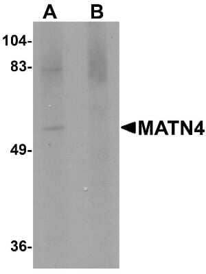 Western Blot: Matrilin-4 Antibody [NBP1-77012] - Rat brain tissue lysate with MATN4 antibody at 1 ug/mL in (A) the absence and (B) the presence of blocking peptide.