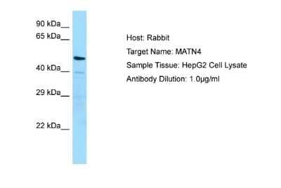 Western Blot: Matrilin-4 Antibody [NBP1-98551] - Antibody Dilution: 1.0ug/ml Sample Tissue: HepG2 cell lysate.