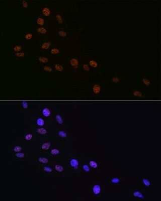 Immunocytochemistry/Immunofluorescence: Matrin 3 Antibody (10O1D1) [NBP3-15307] - Immunofluorescence analysis of C6 cells using Matrin 3 Rabbit mAb (NBP3-15307) at dilution of 1:100 (40x lens). Blue: DAPI for nuclear staining.