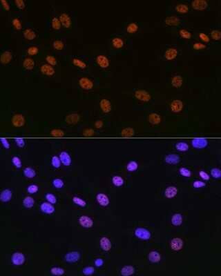 Immunocytochemistry/Immunofluorescence: Matrin 3 Antibody (10O1D1) [NBP3-15307] - Immunofluorescence analysis of NIH-3T3 cells using Matrin 3 Rabbit mAb (NBP3-15307) at dilution of 1:100 (40x lens). Blue: DAPI for nuclear staining.