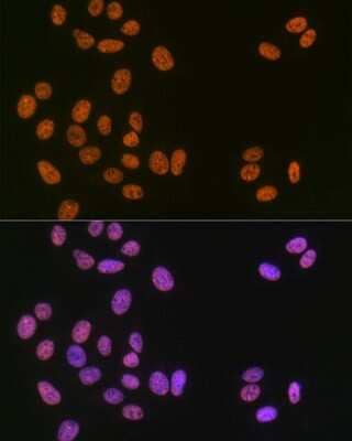 Immunocytochemistry/Immunofluorescence: Matrin 3 Antibody (10O1D1) [NBP3-15307] - Immunofluorescence analysis of U-2 OS cells using Matrin 3 Rabbit mAb (NBP3-15307) at dilution of 1:100 (40x lens). Blue: DAPI for nuclear staining.