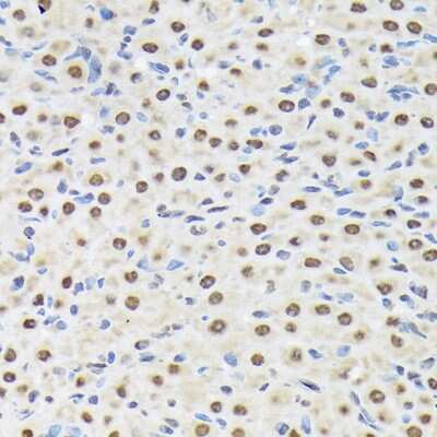 Immunohistochemistry-Paraffin: Matrin 3 Antibody (10O1D1) [NBP3-15307] - Immunohistochemistry of paraffin-embedded rat ovary using Matrin 3 Rabbit mAb (NBP3-15307) at dilution of 1:100 (40x lens).Perform microwave antigen retrieval with 10 mM Tris/EDTA buffer pH 9.0 before commencing with IHC staining protocol.