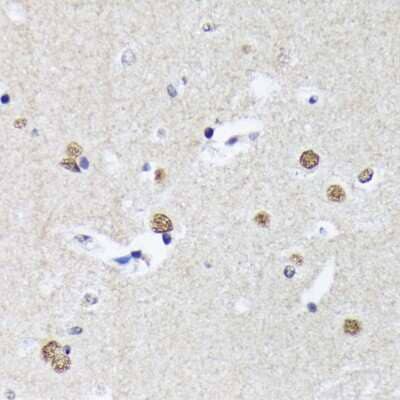 Immunohistochemistry-Paraffin: Matrin 3 Antibody (10O1D1) [NBP3-15307] - Immunohistochemistry of paraffin-embedded human brain using Matrin 3 Rabbit mAb (NBP3-15307) at dilution of 1:100 (40x lens).Perform microwave antigen retrieval with 10 mM Tris/EDTA buffer pH 9.0 before commencing with IHC staining protocol.