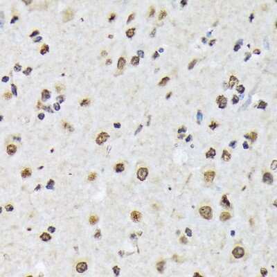 Immunohistochemistry-Paraffin: Matrin 3 Antibody (10O1D1) [NBP3-15307] - Immunohistochemistry of paraffin-embedded mouse spinal cord using Matrin 3 Rabbit mAb (NBP3-15307) at dilution of 1:100 (40x lens).Perform microwave antigen retrieval with 10 mM Tris/EDTA buffer pH 9.0 before commencing with IHC staining protocol.