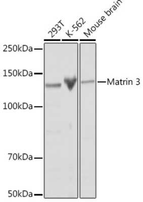 Western Blot: Matrin 3 Antibody (10O1D1) [NBP3-15307] - Western blot analysis of extracts of various cell lines, using Matrin 3 Rabbit mAb (NBP3-15307) at 1:1000 dilution. Secondary antibody: HRP Goat Anti-Rabbit IgG (H+L) at 1:10000 dilution. Lysates/proteins: 25ug per lane. Blocking buffer: 3% nonfat dry milk in TBST. Detection: ECL Basic Kit. Exposure time: 10s.