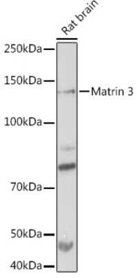 Western Blot: Matrin 3 Antibody (10O1D1) [NBP3-15307] - Western blot analysis of extracts of Rat brain, using Matrin 3 Rabbit mAb (NBP3-15307) at 1:1000 dilution. Secondary antibody: HRP Goat Anti-Rabbit IgG (H+L) at 1:10000 dilution. Lysates/proteins: 25ug per lane. Blocking buffer: 3% nonfat dry milk in TBST. Detection: ECL Basic Kit. Exposure time: 30s.