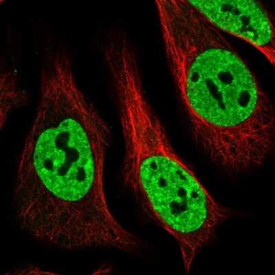 Immunocytochemistry/Immunofluorescence: Matrin 3 Antibody [NBP1-87859] - Staining of human cell line U-2 OS shows localization to nucleoplasm. Antibody staining is shown in green.