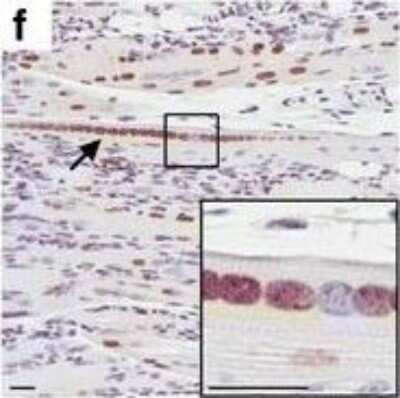 Immunohistochemistry: Matrin 3 Antibody [NB100-1761] - Striking muscle pathology of gastrocnemius in Tg mice from Fo. 1579. Matrin 3 immunohistochemistry of f longitudinal sections from phenotypic Tg show an increase in Matrin 3 immunoreactivity compared to NT transverse and longitudinal sections. * indicates rounded fiber. Arrow head indicates subsarcolemmal nucleus. Arrow indicates nuclear chain. Scale bars measure 25 um Image collected and cropped by CiteAb from the following publication (//actaneurocomms.biomedcentral.com/articles/10.1186/s40478-016-0393-5), licensed under a CC-BY license.