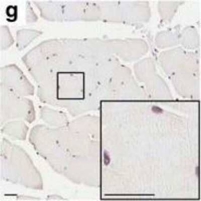 Immunohistochemistry: Matrin 3 Antibody [NB100-1761] - Striking muscle pathology of gastrocnemius in Tg mice from Fo. 1579. Matrin 3 immunohistochemistry of transverse and longitudinal sections. * indicates rounded fiber. Arrow head indicates subsarcolemmal nucleus. Arrow indicates nuclear chain. Scale bars measure 25 um Image collected and cropped by CiteAb from the following publication (//actaneurocomms.biomedcentral.com/articles/10.1186/s40478-016-0393-5), licensed under a CC-BY license.