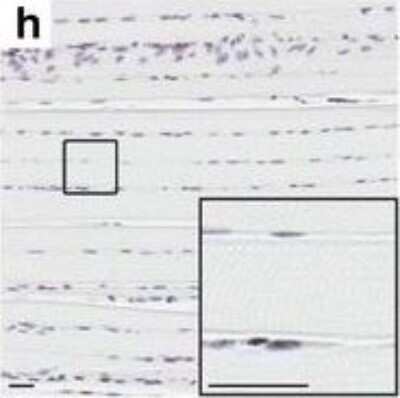 Immunohistochemistry: Matrin 3 Antibody [NB100-1761] - Striking muscle pathology of gastrocnemius in Tg mice from Fo. 1579. Matrin 3 immunohistochemistry of NT transverse and longitudinal sections. * indicates rounded fiber. Arrow head indicates subsarcolemmal nucleus. Arrow indicates nuclear chain. Scale bars measure 25 um Image collected and cropped by CiteAb from the following publication (//actaneurocomms.biomedcentral.com/articles/10.1186/s40478-016-0393-5), licensed under a CC-BY license.