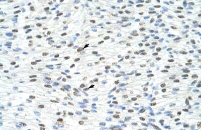 Immunohistochemistry: Matrin 3 Antibody [NBP1-57359] - Human Heart Cellular data: Myocardial cells Antibody Concentration: 4.0-8.0 ug/ml Magnification: 400X.