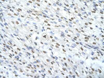 Immunohistochemistry: Matrin 3 Antibody [NBP1-57359] - Human cardiac cell Cellular data: Epithelial cells of renal tubule Antibody Concentration: 4.0-8.0 ug/ml Magnification: 400X.