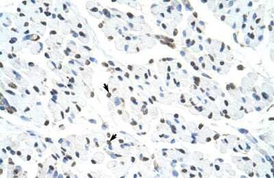 Immunohistochemistry-Paraffin: Matrin 3 Antibody [NBP1-57359] - Human Muscle Tissue, Skeletal muscle cells (Indicated with Arrows) 4-8ug/ml.