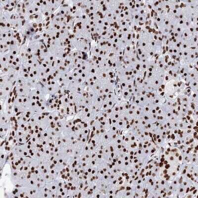 Immunohistochemistry-Paraffin: Matrin 3 Antibody [NBP1-87859] - Staining of human pancreas shows moderate nuclear positivity in exocrine glandular cells.