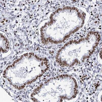 Immunohistochemistry-Paraffin: Matrin 3 Antibody [NBP1-87859] - Staining of human endometrium shows moderate nuclear positivity in glandular cells.