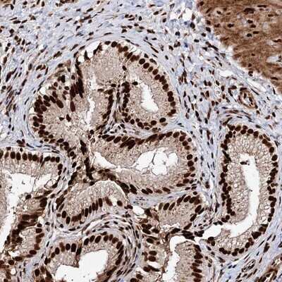 Immunohistochemistry-Paraffin: Matrin 3 Antibody [NBP1-87860] - Staining of human gall bladder shows strong nuclear positivity in glandular cells.