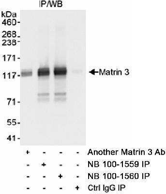 <b>Independent Antibodies Validation. </b>Immunoprecipitation: Matrin 3 Antibody [NB100-1559] - Detection of Human Matrin 3 by Western Blot after Immunoprecipitation. Samples: Whole cell lysate (1 mg for IP, 1/4 of IP loaded) from HeLa cells.  Antibodies: Affinity purified rabbit anti-Matrin 3 antibody NB100-1559 used for IP at 3 mcg/mg lysate. Matrin 3 was also immunoprecipitated using rabbit anti-Matrin 3 NB100-1560 and another Matrin 3 Ab at 3 mcg/mg lysate.  Detection:  Chemiluminescence with an exposure time of 3 seconds.