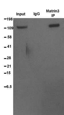 Immunoprecipitation: Matrin 3 Antibody [NB100-1761] - IP of human fibroblasts. Image from verified customer review.