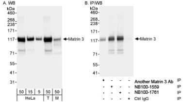 Immunoprecipitation: Matrin 3 Antibody [NB100-1761] - Detection of Human and Mouse Matrin 3 on HeLa whole cell lysate using NB100-1761. Matrin 3 was also immunoprecipitated using another rabbit anti-Matrin 3 antibody and NB100-1559.