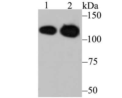Western Blot: Matrin 3 Antibody (JU93-43) [NBP2-75567] - Analysis of Matrin 3 on different lysates using anti-Matrin 3 antibody at 1/1,000 dilution.Positive control:Lane 1: Daudi    Lane 2: Mouse brain tissue