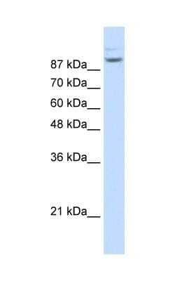 Western Blot: Matrin 3 Antibody [NBP1-57359] - Jurkat cell lysate, Antibody Titration: 1.25ug/ml