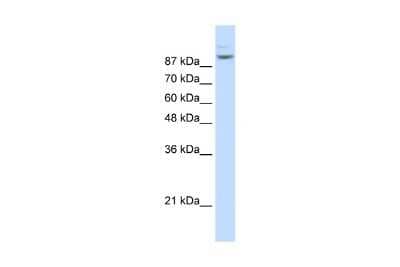 Western Blot: Matrin 3 Antibody [NBP1-57359] - Antibody  Titration: 1. 25 ug/ml Positive control: Jurkat cell lysate MATR3 is strongly supported by BioGPS gene expression data to be expressed in Human Jurkat cells.