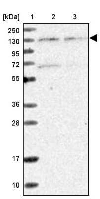 Western Blot: Matrin 3 Antibody [NBP1-87860] - Lane 1: Marker  [kDa] 250, 130, 95, 72, 55, 36, 28, 17, 10.  Lane 2: Human cell line RT-4.  Lane 3: Human cell line U-251MG sp