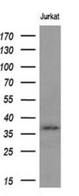 Western Blot: Mcl-1 Antibody (OTI10F6) - Azide and BSA Free [NBP2-72598] - HEK293T cells were transfected with the pCMV6-ENTRY control (Left lane) or pCMV6-ENTRY MCL1 (Right lane) cDNA for 48 hrs and lysed. Equivalent amounts of cell lysates (5 ug per lane) were separated by SDS-PAGE and immunoblotted with anti-MCL1