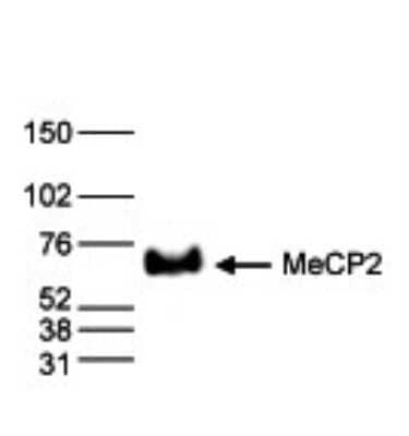 Western Blot: MeCP2 Antibody [NBP2-59229] - Nuclear extracts (40 ug) from HeLa cells were analysed by Western blot using the antibody against MeCP2 diluted 1:1,000 in TBS-Tween containing 5% skimmed milk. The position of the protein of interest is indicated on the right; the marker (in kDa) is shown on the left.
