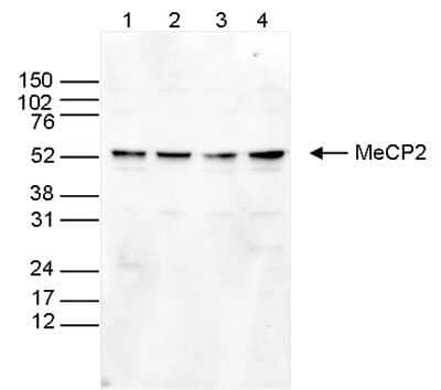 Western Blot: MeCP2 Antibody [NBP2-59230] - Whole cell extracts (25 ug) from HeLa (lane 1), MCF7 (lane 2), K562 (lane 3) and NIH3T3 cells (lane 4) were analysed by Western blot using the antibody against MeCP2 diluted 1:1,000 in TBS-Tween containing 5% skimmed milk. The position of the protein of interest is indicated on the right; the marker (in kDa) is shown on the left.