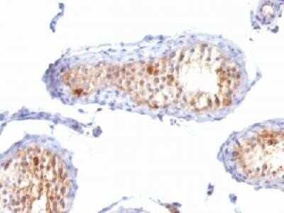 Immunohistochemistry-Paraffin: Melan-A/MART-1 Antibody (A103 + M2-7C10 + M2-9E3) - Azide and BSA Free [NBP2-34546] - Immunohistochemistry-Paraffin: Melan-A/MART-1 Antibody (A103 + M2-7C10 + M2-9E3) [NBP2-34244]