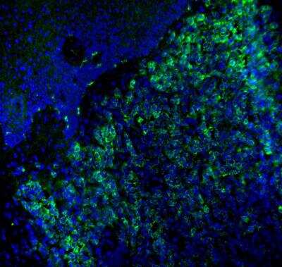 Immunohistochemistry-Frozen: Melan-A/MART-1 Antibody (M2-7C10) [Alexa Fluor® 488] [NBP2-33148AF488] - Melan-A (green) was detected in human skin (melanoma) using Melan-A-AlexaFluor488 antibody (1:40; 1 hour) in PBS. Nuclei were stained with DAPI (blue). Tissue was fixed in acetone. Image from a verified customer review.