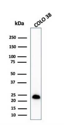 Western Blot: Melan-A/MART-1 Antibody (MLANA/1409R) - Azide and BSA Free [NBP2-54443] - Western Blot Analysis of COLO-38 cell lysate using Melan-A/MART-1 Rabbit Recombinant Monoclonal Antibody (MLANA/1409R).