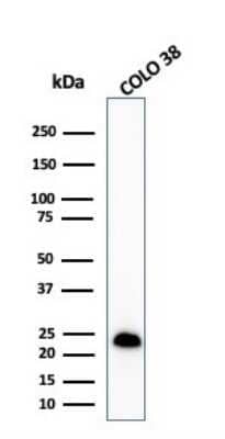 Western Blot: Melan-A/MART-1 Antibody (MLANA/1409R) [NBP2-53301] - Western Blot Analysis of COLO-38 cell lysate using Melan-A/MART-1 Rabbit Recombinant Monoclonal Antibody (MLANA/1409R).