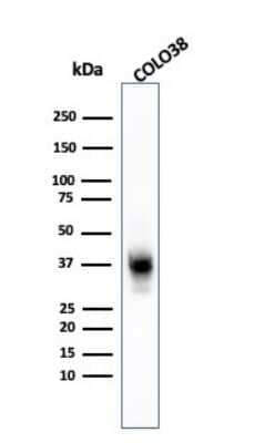 Western Blot: Melanoma Marker (MART-1 + Tyrosinase + gp100) Antibody (A103 + T311 + HMB45) - Azide and BSA Free [NBP2-34547] - Western Blot Analysis of COLO-38 cell lysate using Melanoma Marker (MART-1 + Tyrosinase + gp100) MAb (A103 + T311 + HMB45).