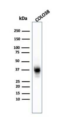 Western Blot Melanoma Marker (MART-1 + Tyrosinase + gp100) Antibody (A103 + T311 + HMB45)