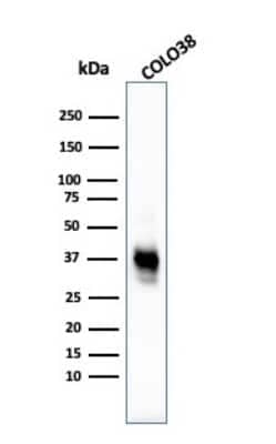 Western Blot: Melanoma Marker (MART-1 + Tyrosinase + gp100) Antibody (M2-7C10 + M2-9E3 + T311 + HMB45) - Azide and BSA Free [NBP2-34681] - Western Blot Analysis of COLO38 cell lysate using Melanoma Marker (MART-1 + Tyrosinase + gp100) MAb (M2-7C10 + M2-9E3 + T311 + HMB45).