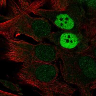 Immunocytochemistry/Immunofluorescence: Melanoma antigen family C2 Antibody [NBP2-34145] - Staining of human cell line SK-MEL-30 shows localization to nucleus & nucleoli.