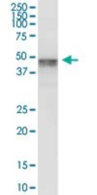 Western Blot: Melanoma antigen family C2 Antibody [H00051438-B01P] - Analysis of MAGEC2 expression in human placenta.